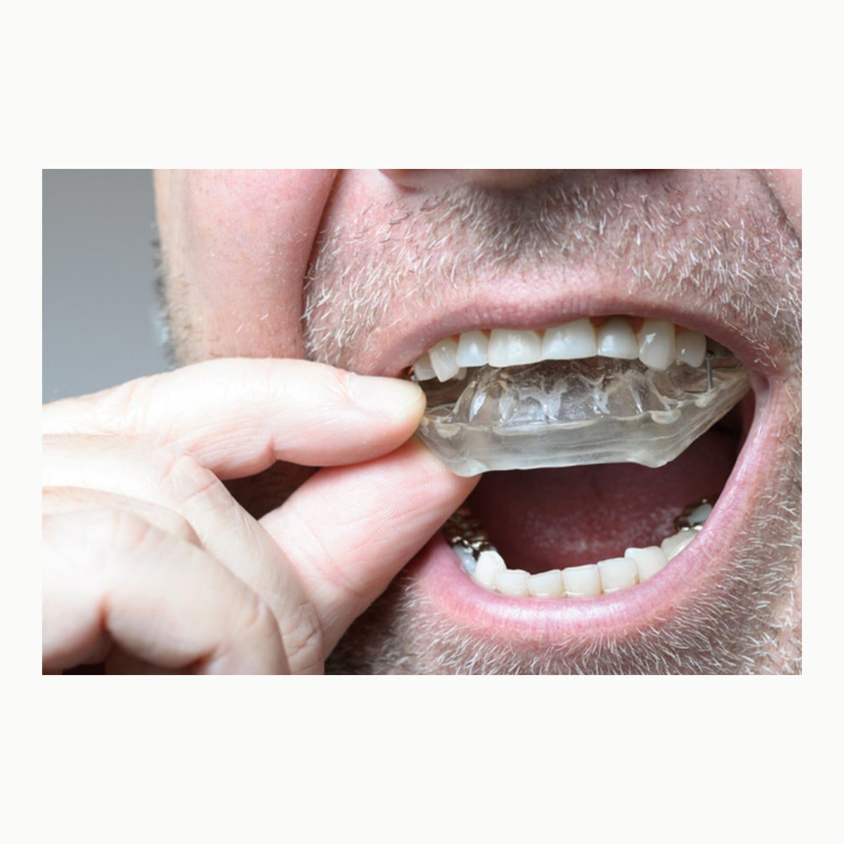 Férula dental noche Férula dental para noche, 4 unidades, 2 tamaños